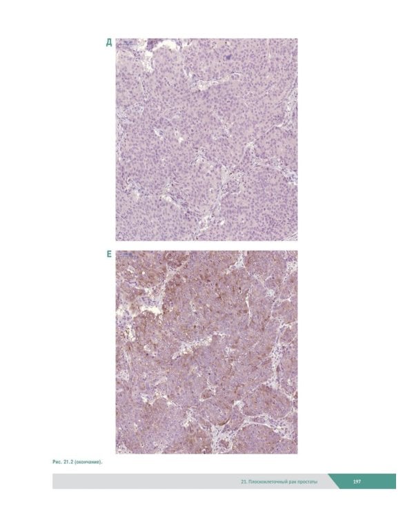 Морфологическая диагностика заболеваний простаты. Руководство для врачей