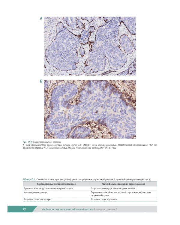 Морфологическая диагностика заболеваний простаты. Руководство для врачей