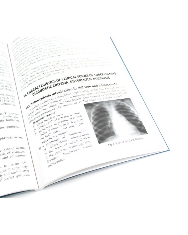 Diagnosis and prevention of tuberculosis in general medical practice: tutorial guide = Диагностика и профилактика туберкулеза в общей врачебной практи