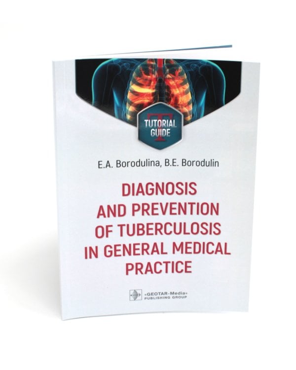 Diagnosis and prevention of tuberculosis in general medical practice: tutorial guide = Диагностика и профилактика туберкулеза в общей врачебной практи