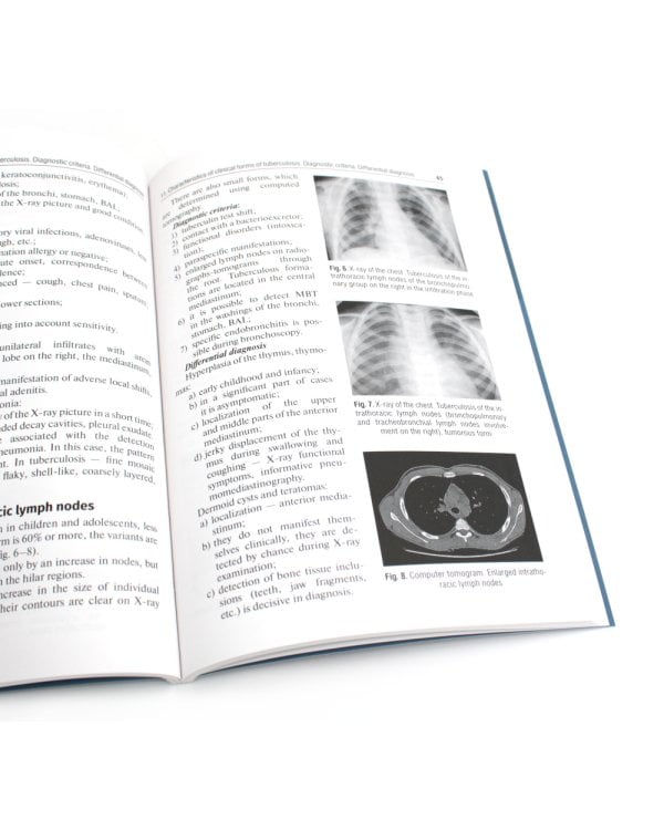Diagnosis and prevention of tuberculosis in general medical practice: tutorial guide = Диагностика и профилактика туберкулеза в общей врачебной практи