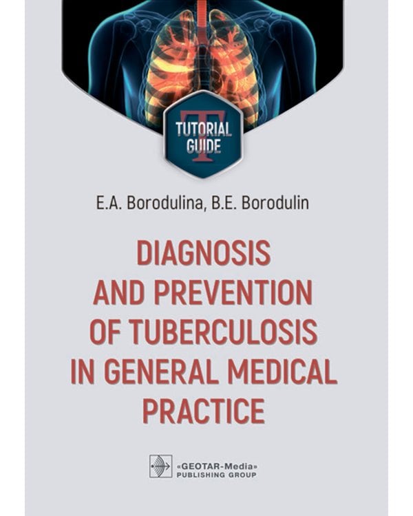 Diagnosis and prevention of tuberculosis in general medical practice: tutorial guide = Диагностика и профилактика туберкулеза в общей врачебной практи