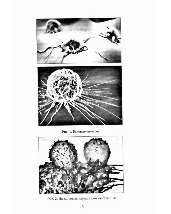 Рак. Причины возникновения и профилактика. Мифы и реальность
