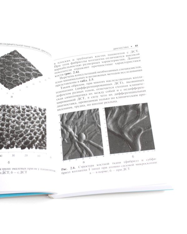 Дисплазия соединительной ткани. 2-е изд., испр. и доп