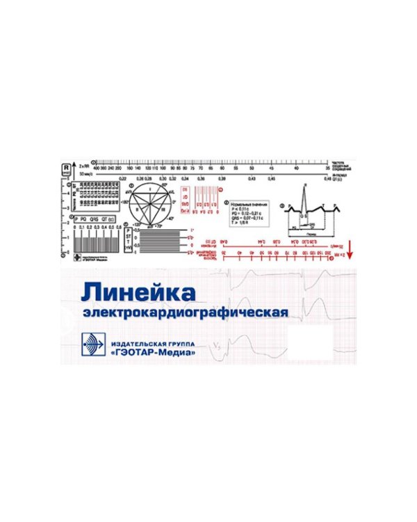 Линейка электрокардиографическая: ЭКГ-линейка для расшифровки электрокардиограммы, снятой со скоростью 50 или 25 мм/с