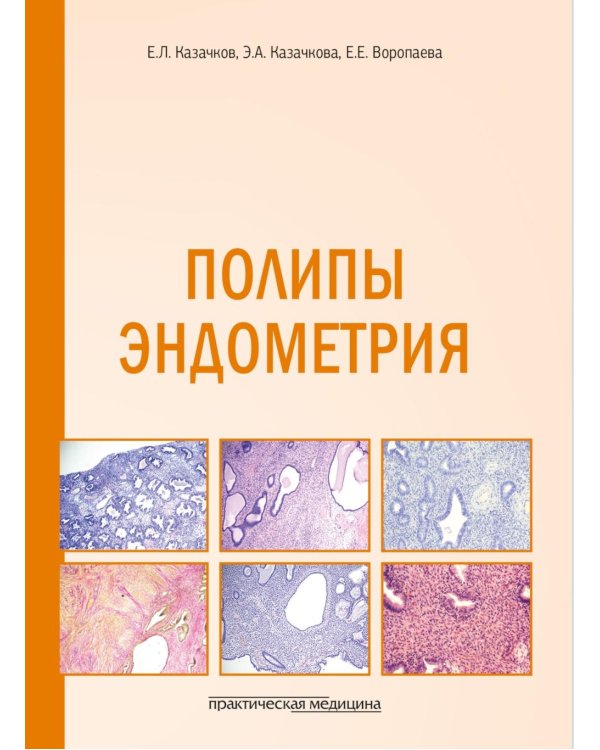 Полипы эндометрия: Учебное пособие