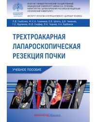 Трехтроакарная лапароскопическая резекция почки: Учебное пособие