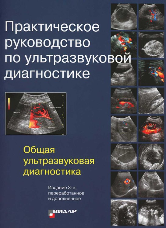 Практическое руководство по ультразвуковой диагностике. Общая ультразвуковая диагностика. 3-е изд., перераб.и доп Практическое руководство по ультразвуковой диагностике. Общая ультразвуковая диагностика. 3-е изд., перераб.и доп