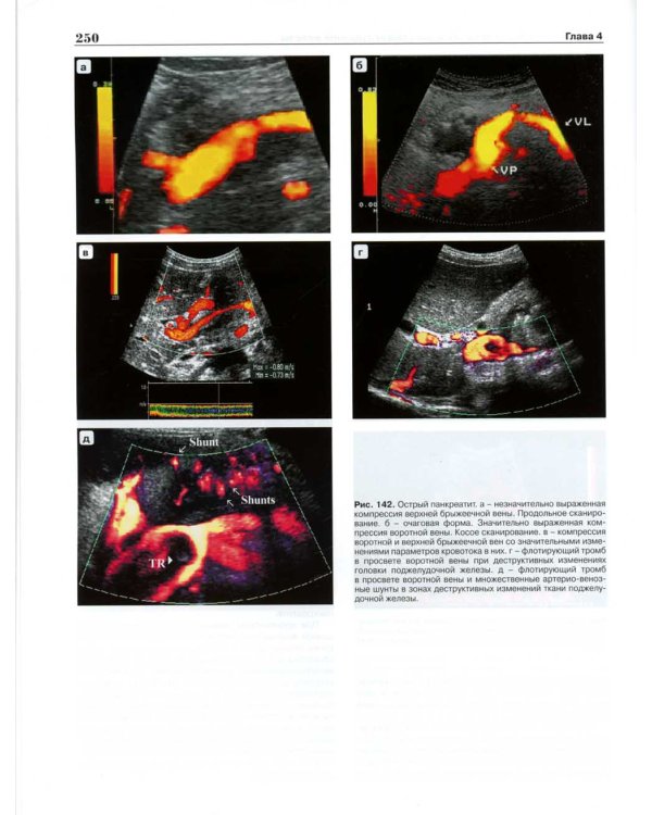 Практическое руководство по ультразвуковой диагностике. Общая ультразвуковая диагностика. 3-е изд., перераб.и доп