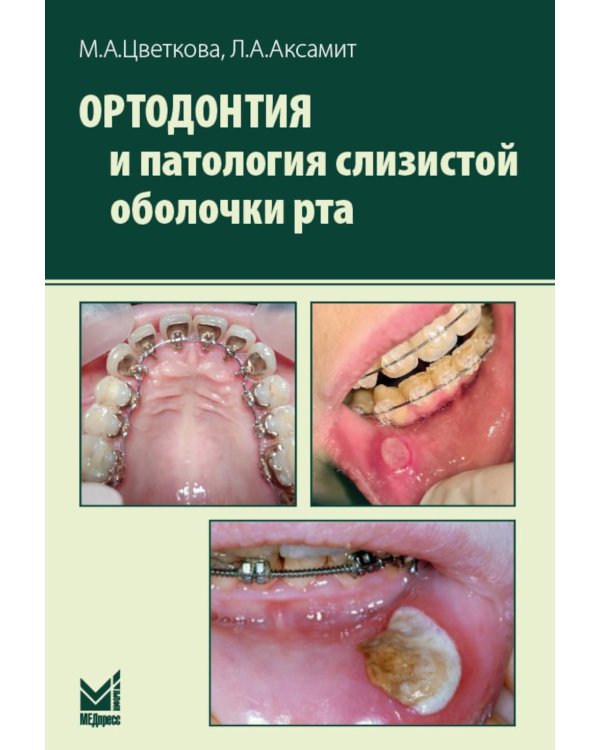 Ортодонтия и патология слизистой оболочки рта