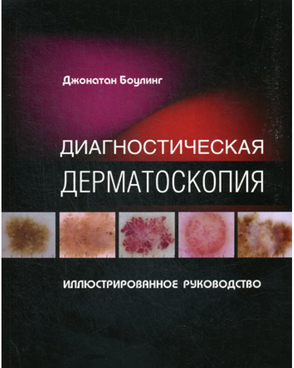 Диагностическая дерматоскопия. Иллюстрированное руководство