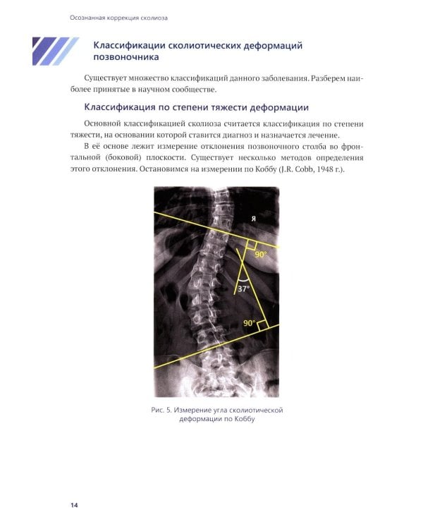 Осознанная коррекция сколиоза: Учебно-методическое пособие. Научно-практическое руководство. 2-е изд., испр. и доп