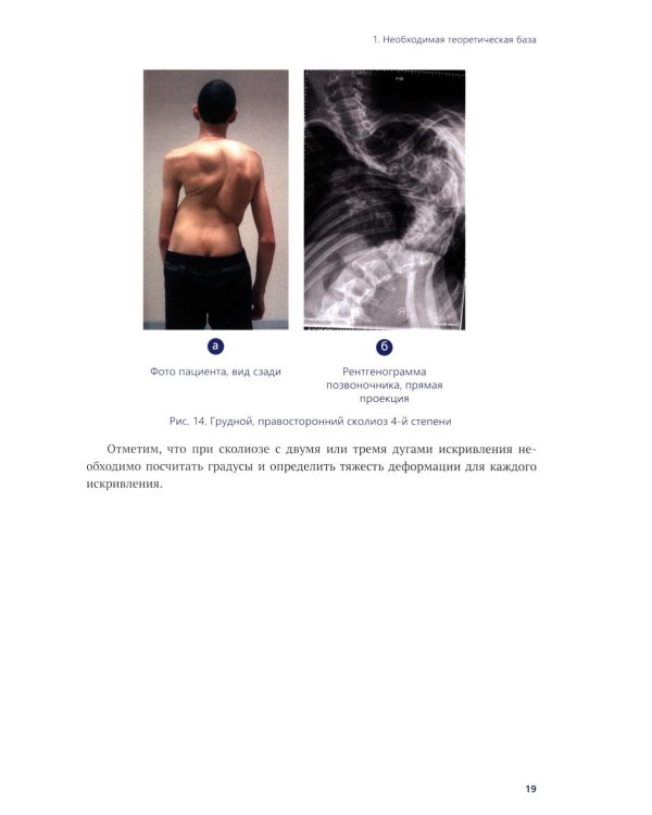 Осознанная коррекция сколиоза: Учебно-методическое пособие. Научно-практическое руководство. 2-е изд., испр. и доп