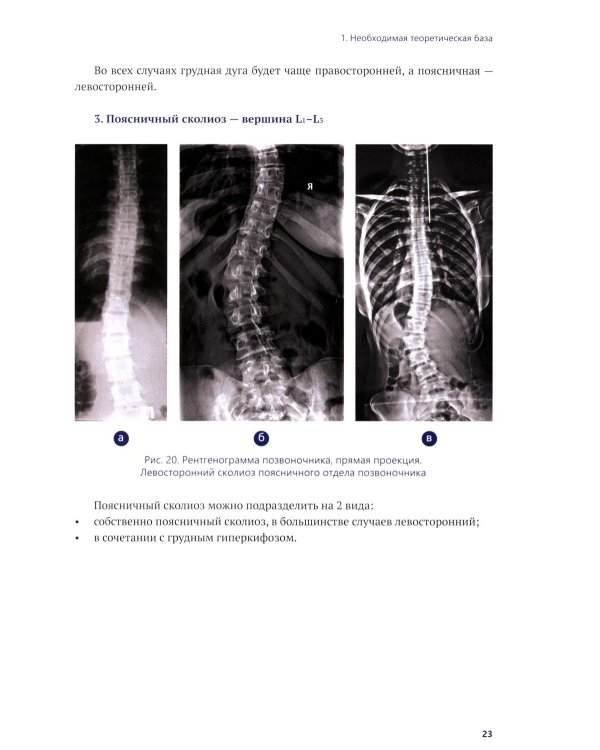 Осознанная коррекция сколиоза: Учебно-методическое пособие. Научно-практическое руководство. 2-е изд., испр. и доп