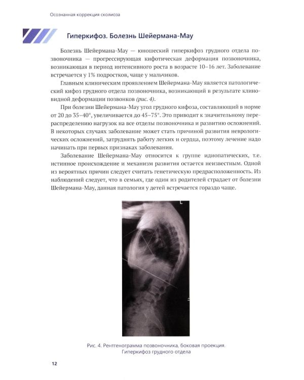 Осознанная коррекция сколиоза: Учебно-методическое пособие. Научно-практическое руководство. 2-е изд., испр. и доп