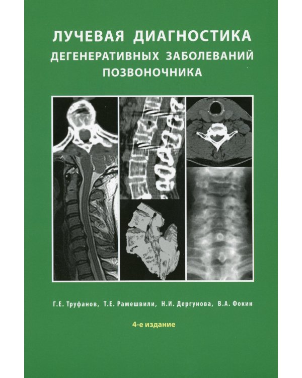 Лучевая диагностика дегенеративных заболеваний позвоночника. 4-е изд