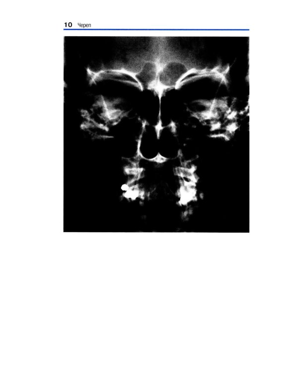 Карманный атлас рентгенологической анатомии. 8-е изд