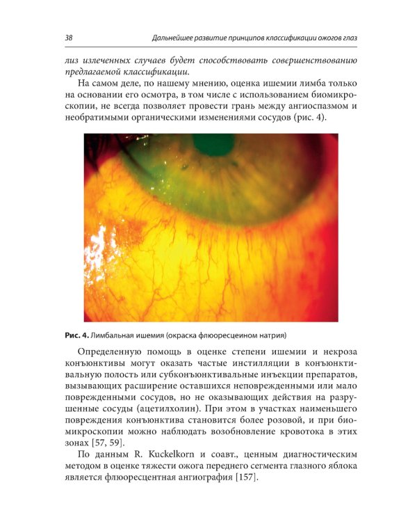 Ожоги глаз. Состояние проблемы и новые подходы. 2-е изд., перераб.и доп