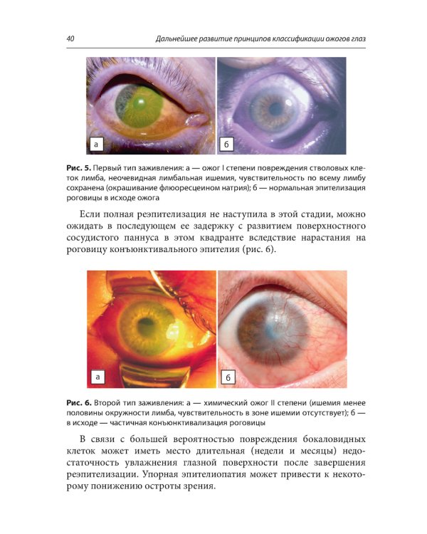 Ожоги глаз. Состояние проблемы и новые подходы. 2-е изд., перераб.и доп