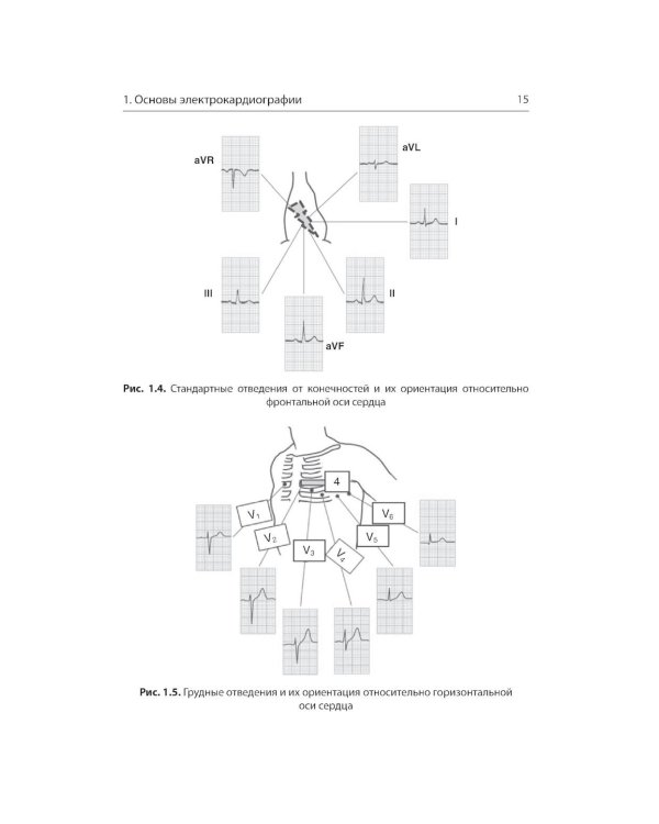 Интерпретация ЭКГ в клинической практике