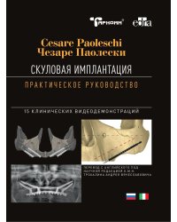 Скуловая имплантация. Практическое руководство - Чезаре Паолески
