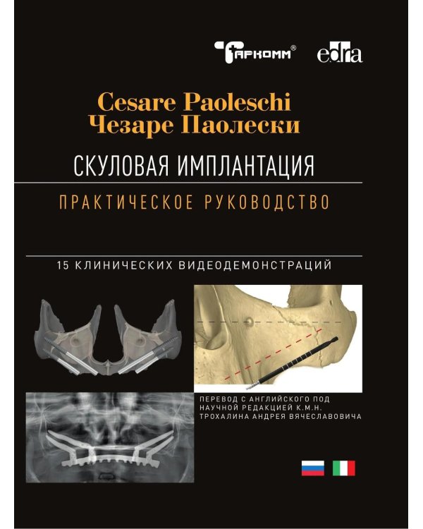 Скуловая имплантация. Практическое руководство - Чезаре Паолески