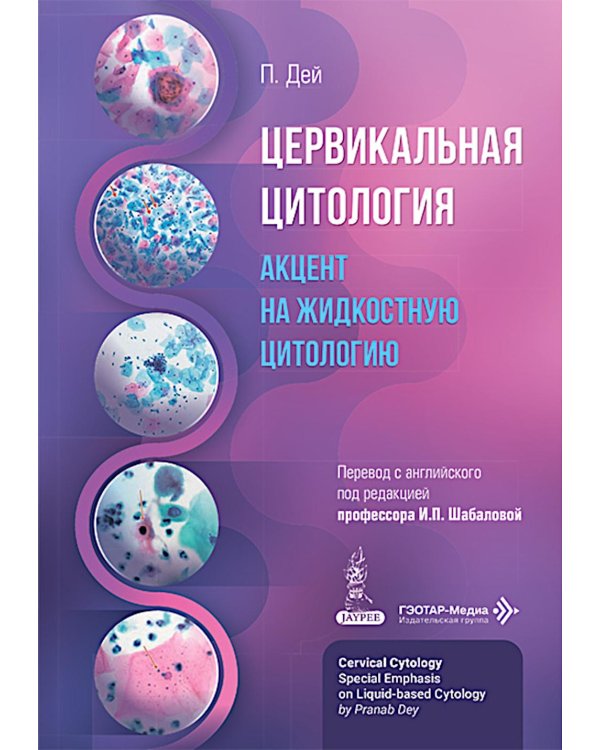 Цервикальная цитология. Акцент на жидкостную цитологию
