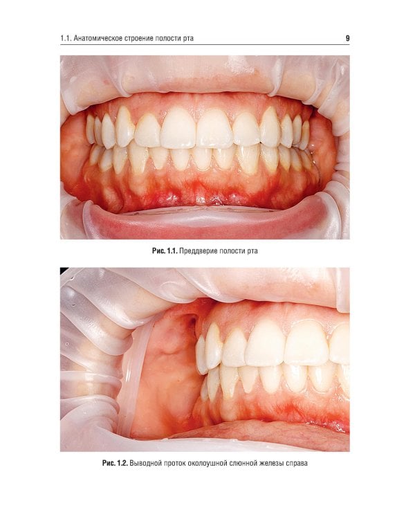 Система коффердам: базовые знания и практические навыки изоляции рабочего поля в клинической стоматологии: Учебное пособие