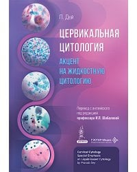 Цервикальная цитология. Акцент на жидкостную цитологию