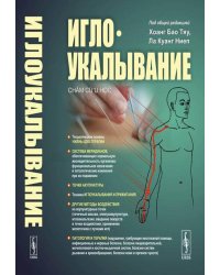 Иглоукалывание. 2-е изд