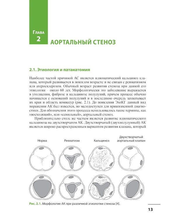 Клапанные пороки сердца. 3-е изд