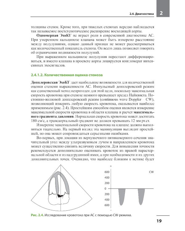 Клапанные пороки сердца. 3-е изд