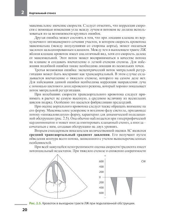 Клапанные пороки сердца. 3-е изд