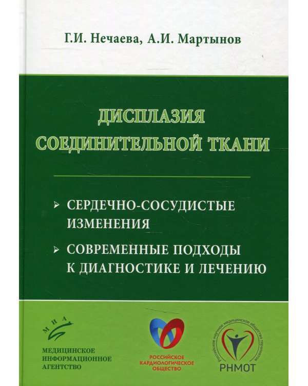 Дисплазия соединительной ткани: сердечно-сосудистые изменения, современные подходы к диагностике и лечению