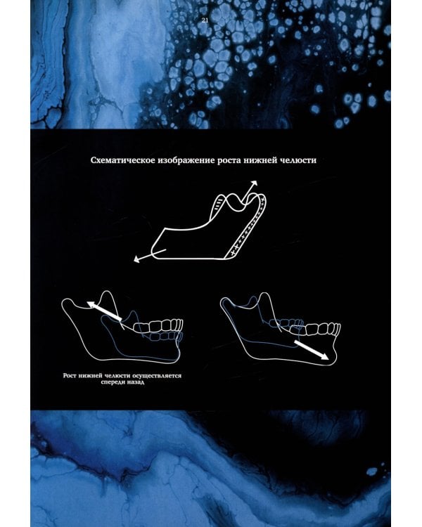 Ортодонтия. Практическое руководство