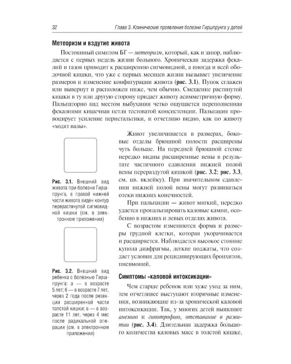Болезнь Гиршпрунга у детей. Руководство для врачей . 2-е изд., перераб. и доп