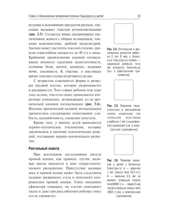 Болезнь Гиршпрунга у детей. Руководство для врачей . 2-е изд., перераб. и доп