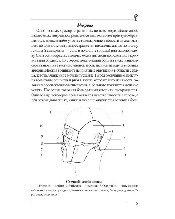 Головная боль