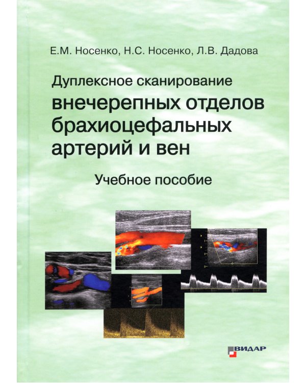 Дуплексное сканирование внечерепных отделов брахиоцефальных артерий и вен: Учебное пособие