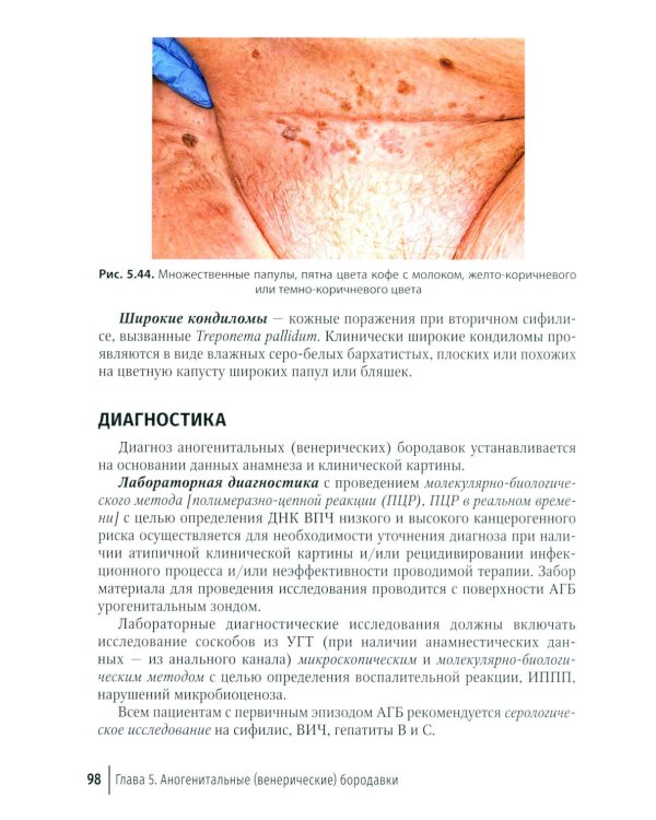 Дополнительное изображение книги «Наиболее распространенные аногенитальные вирусные инфекции: руководство для врачей»