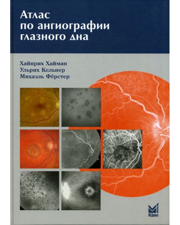 Атлас по ангиографии глазного дна