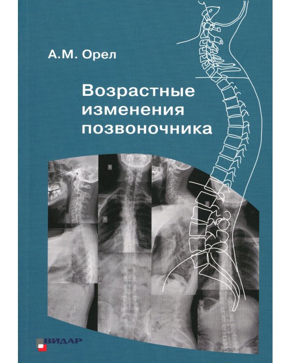 Возрастные изменения позвоночника