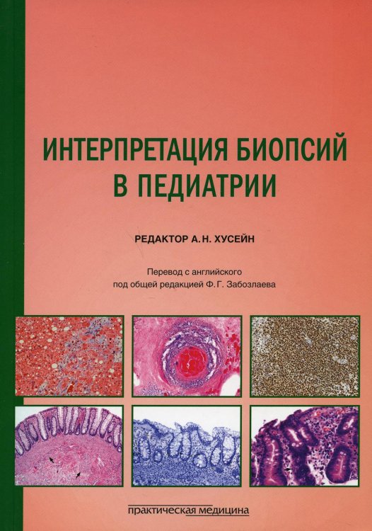 Интерпретация биопсий в педиатрии