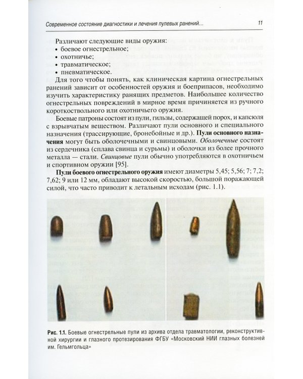 Пулевые ранения глаза и орбиты в мирное время