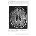Как жить Поговорим о рассеянном склерозе: Семь шагов к преодолению болезни