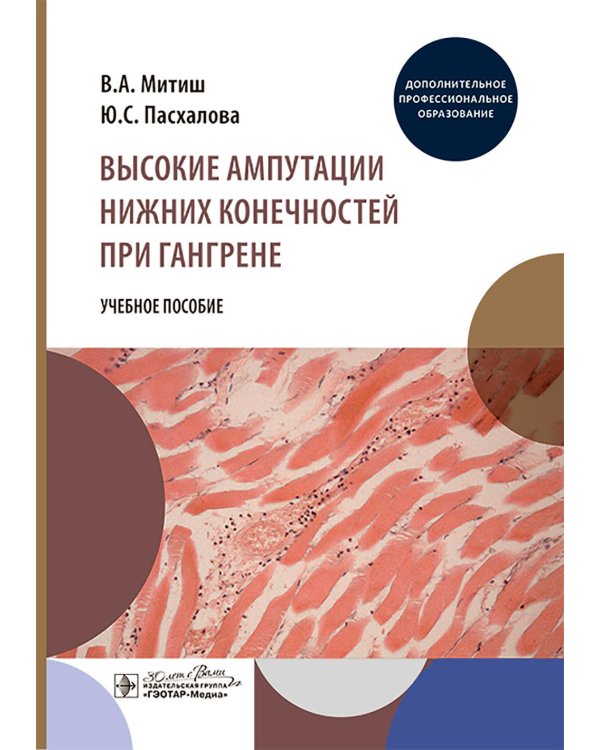 Высокие ампутации нижних конечностей при гангрене: Учебное пособие