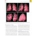 Лучевая диагностика заболеваний органов грудной клетки. В 2 ч. (комплект из 2-х книг)