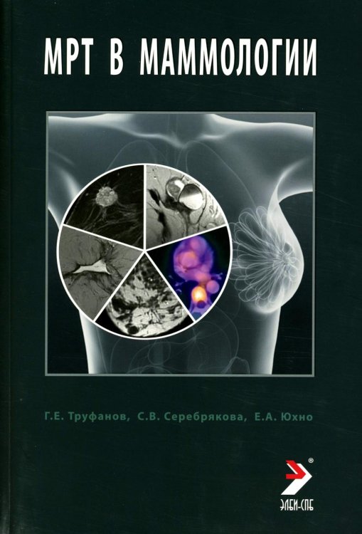 МРТ в маммологии: руководство для врачей