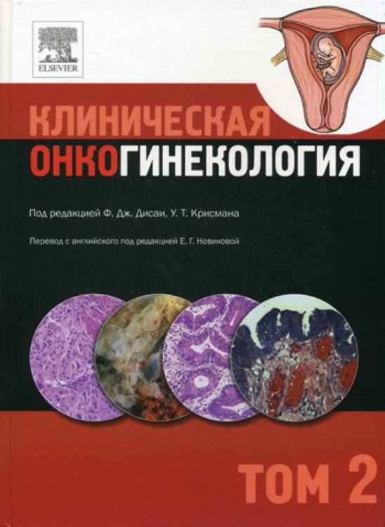 Клиническая онкогинекология. В 3 т. Т. 2 Клиническая онкогинекология. В 3 т. Т. 2