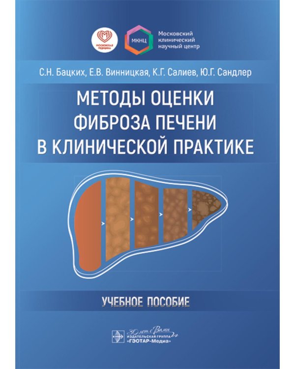 Методы оценки фиброза печени в клинической практике: Учебное пособие